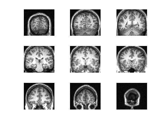 利用matlab编写实现显示fmri切片slice图像 混合显示 不同侧面显示 可叠加t检验图显示 by DR. Rajeev Raizada