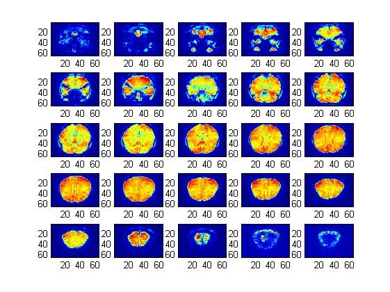 fmri的图像数据在matlab中显示，利用imagesc工具进行显示，自带数据集-by 西南大学xulei教授