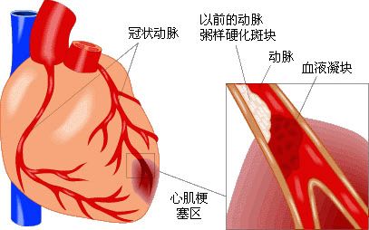 身体求救信号