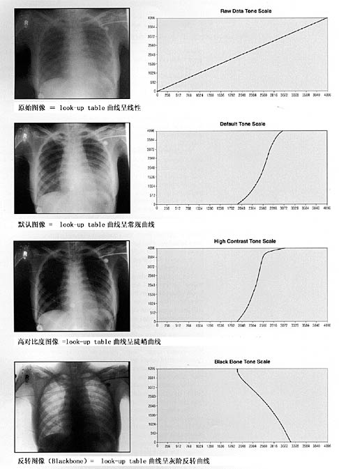 【转帖】我们应该如何选择DR